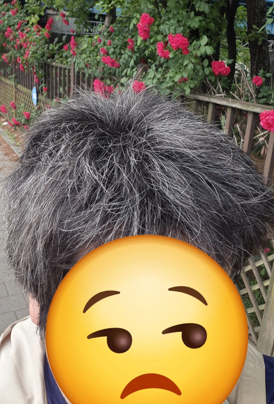흰머리가 암세포를 방어한 흔적?_4.webp