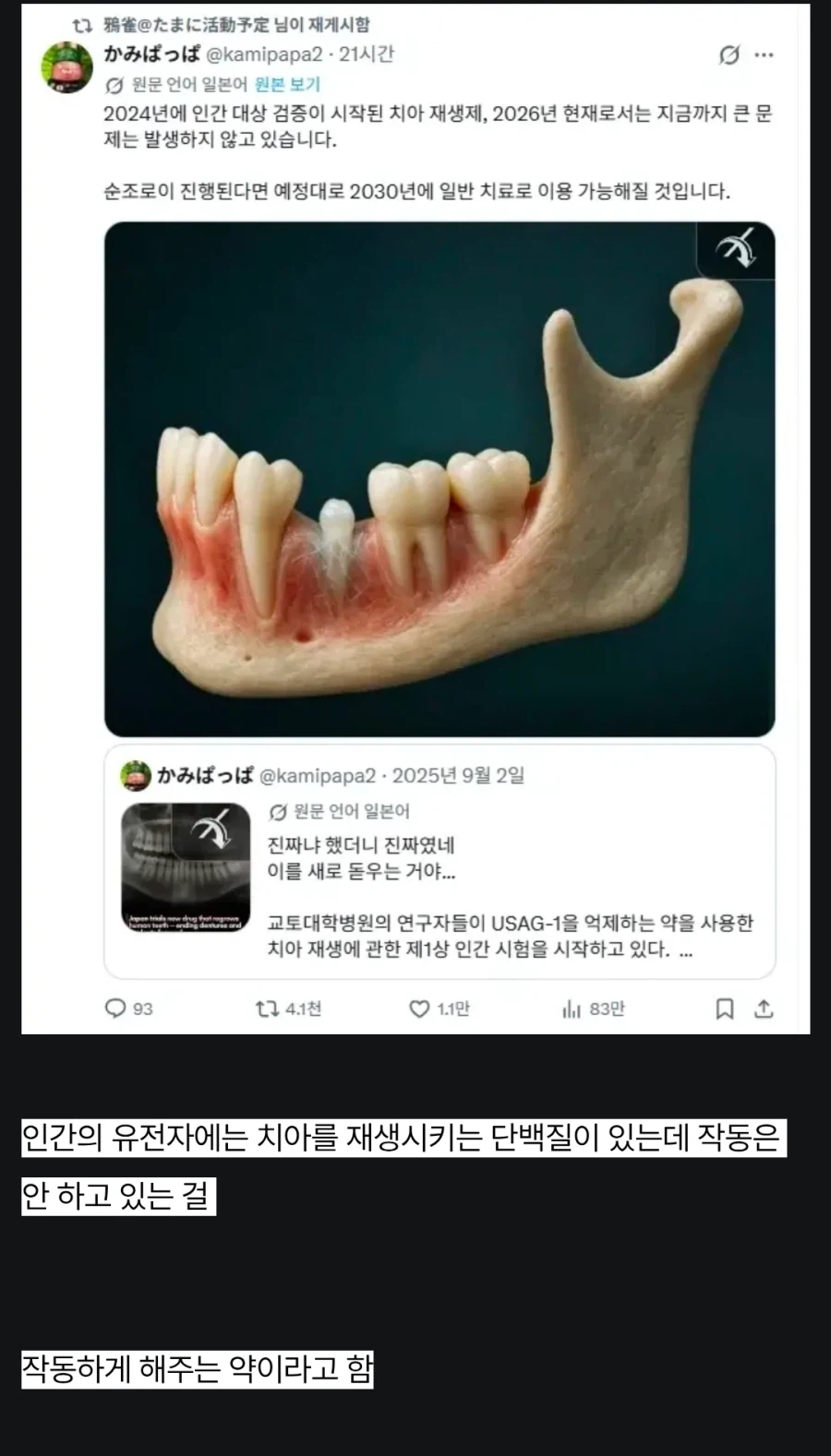 치아 재생 근황_1.webp