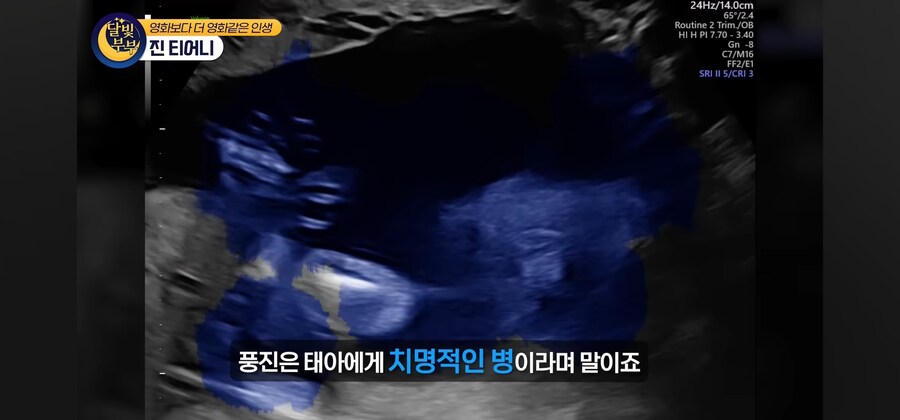 전염병 격리수칙를 무시한 열혈팬 때문에 인생을 망치게 된 여배우_27.jpg