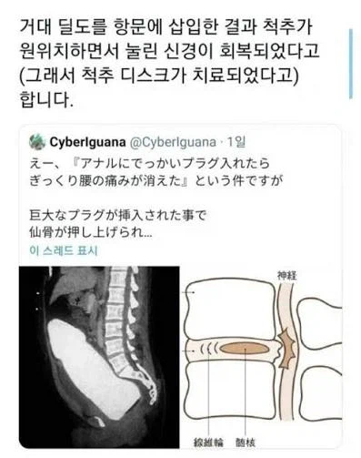 KV) 로제타 짤 특_2.webp