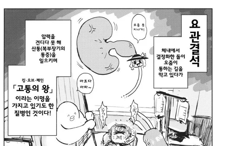 (요로결석) 의외로 사람들 90%가 잘못 알고 있는 정보.JPG_1.webp