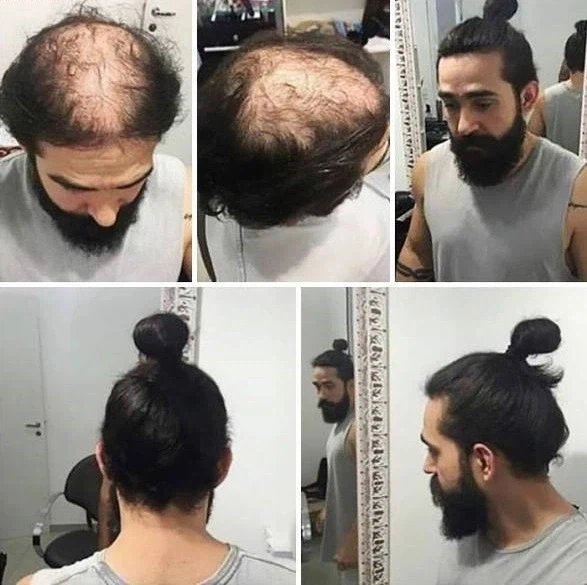 속알머리 감추기.jpg_1.webp