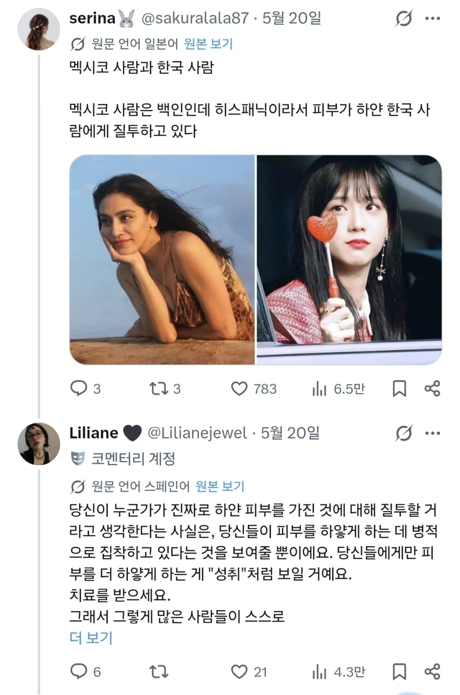 한국인 피부가 하얘서 스트레스 받던 멕시코인 근황.jpg_3.webp