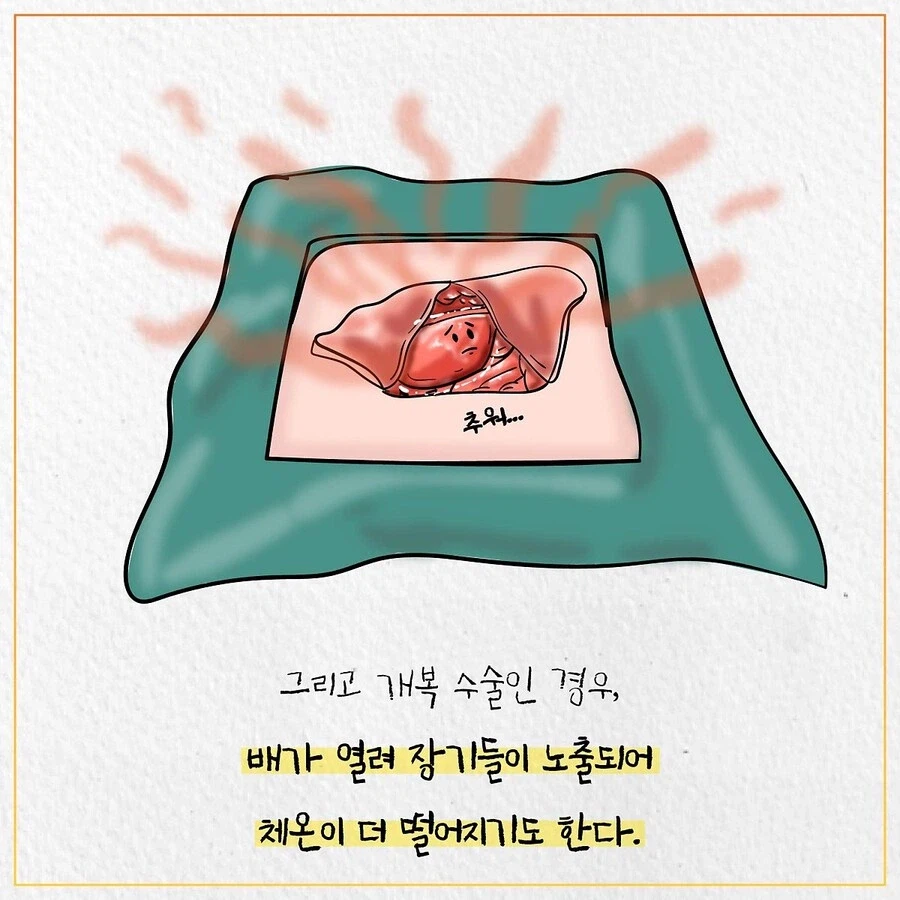 수술실이 춥게 느껴지는 이유_6.webp