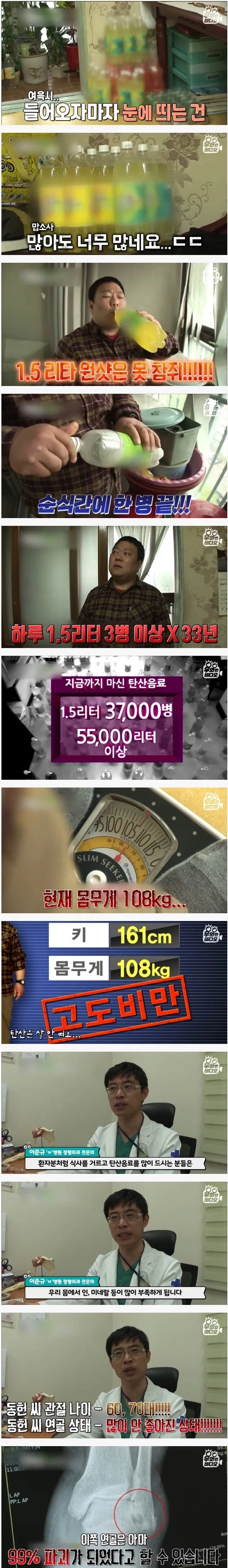 설탕 많이 먹어도 잘 버티는 유전자를 가진 사람들_1.webp